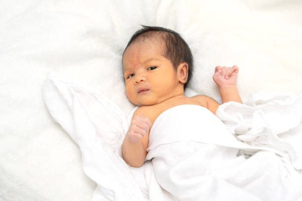 jaundiced baby